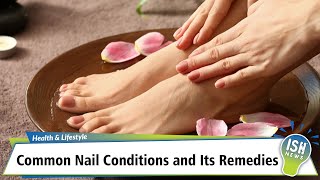 Common Nail Conditions and Its Remedies