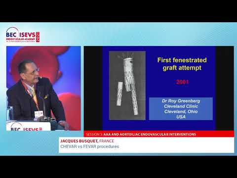BEC 2021 | CHEVAR vs FEVAR procedures | Jacques Busquet