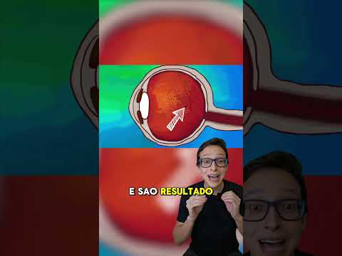 Moscas Volantes 😱#medicina #medico #enfermeira #enfermagem #olhos #oftalmologia #oftalmologista olho