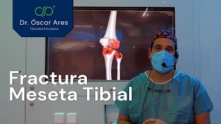 Fractura de la meseta tibial - Dr. Oscar Ares
