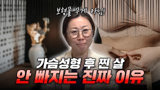 가슴성형 후 찐 살, 왜 안 빠질까?: 수술 후 3kg 이상 살찐분들 보세요...