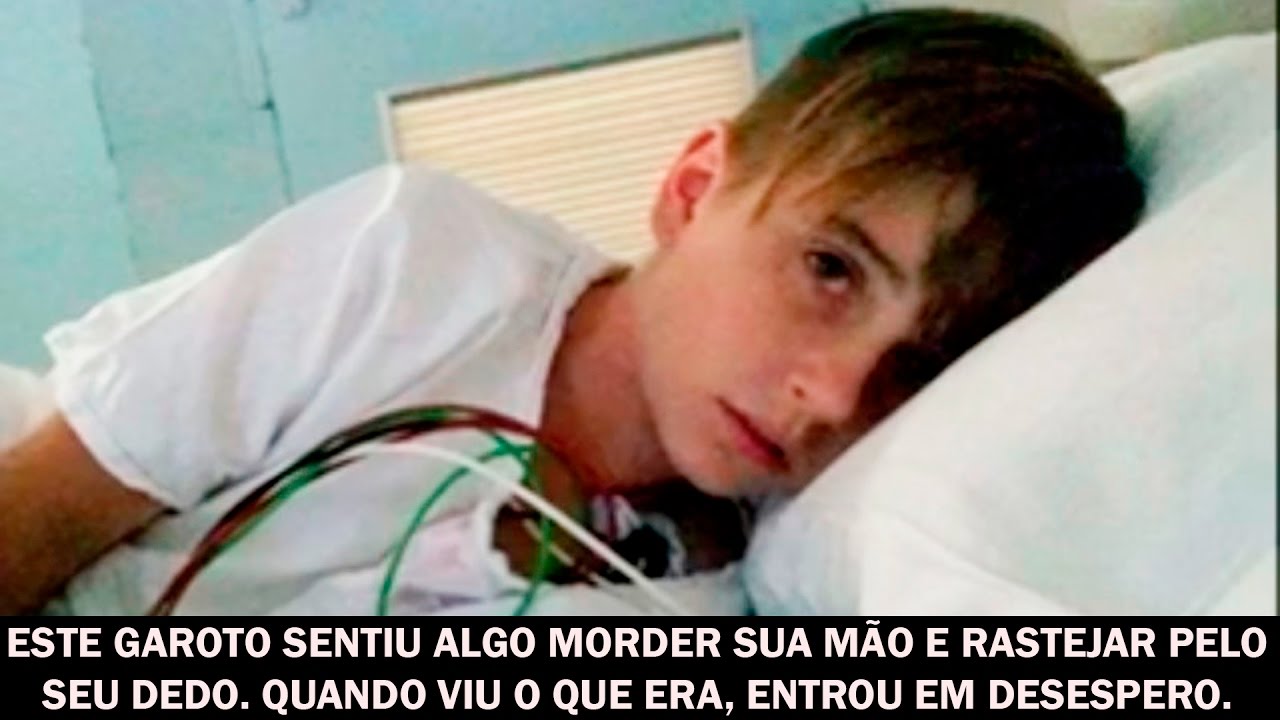 Este garoto sentiu algo morder sua mão e rastejar pelo seu dedo. Quando viu o que era, entrou...