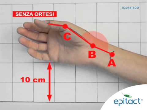 Fisioterapia a condrosi toracica Una limitazione patologica del movimento dellarticolazione