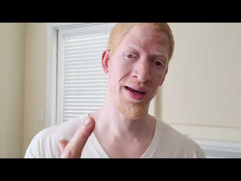 Why Being Ugly is a Blessing.