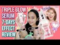 POND'S Triple Glow Serum 1-Week Results | How to Apply Serum Wendy Skin Care Philippines (2022)