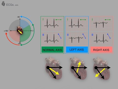 ECG Part 3 QRS Axis