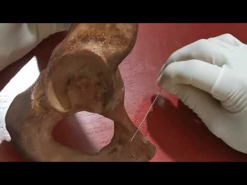 Hueso coxal - detalles anatómicos