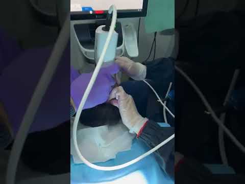Jason talks about dental implants in Costa Rica
