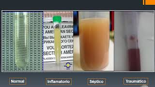 Artritis Séptica (Dra. Mérola)