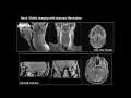 Introduction to medical imaging physics engineering and clinical applications