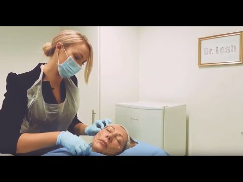 Dr Leah Performs Silhouette Soft Thread Lift (as featured in The Mail Online)