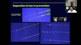 Safe usage of intracanal instruments by Dr. Sourav Banerjee