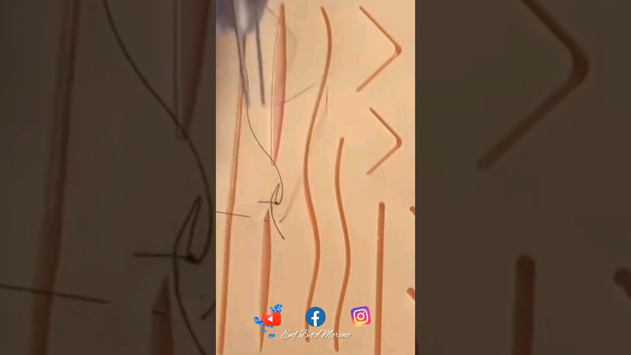 sutura continua simple #enfermería #medicina