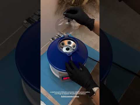 Santé Clínica Estética Barcelona
