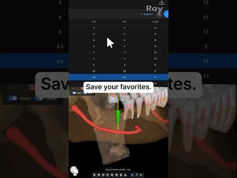 SMARTDent : 5D Tutorial #3-3. Implant Editing with Bone Density Check