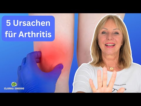 Arthritis: Woher kommt diese schmerzhafte Gelenkentzündung? (einfach erklärt) | Dr. Claudia Bignion