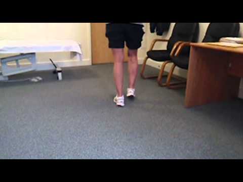 Patient Walking 3 Weeks Post HTO Surgery