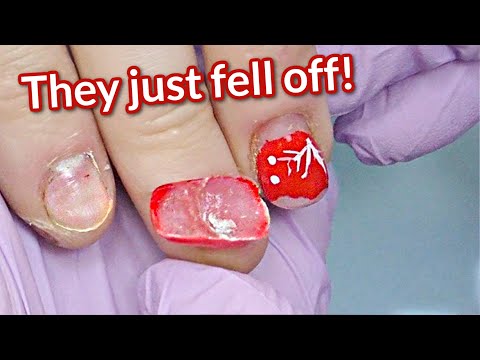 Nails Fell Off After 4 DAYS 😭 Bitten Nails Transformation – Baby Boomer with Dual Forms