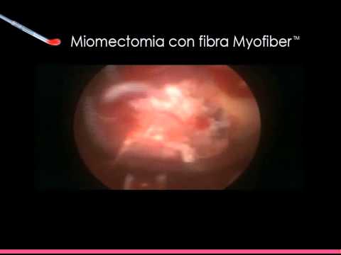Quanto frequente masturbazione influenzano la prostata Per alcune analisi determinato prostatite
