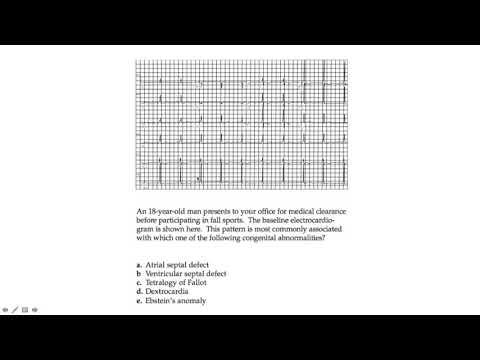 Algorithm 31 : Tachycardia