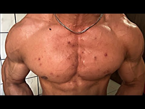 AUMENTAR O PEITO EM 10 MINUTOS TREINO EM CASA SEM EQUIPAMENTOS (Pump no final)