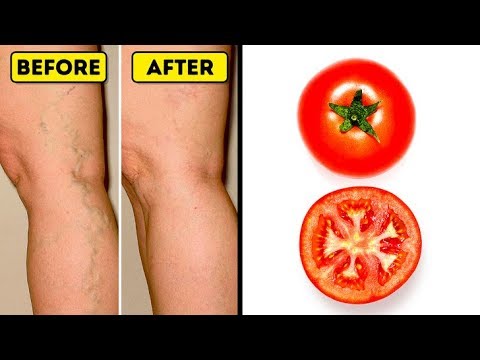Cum se vindecă oțetul de mere picioare în vopsire