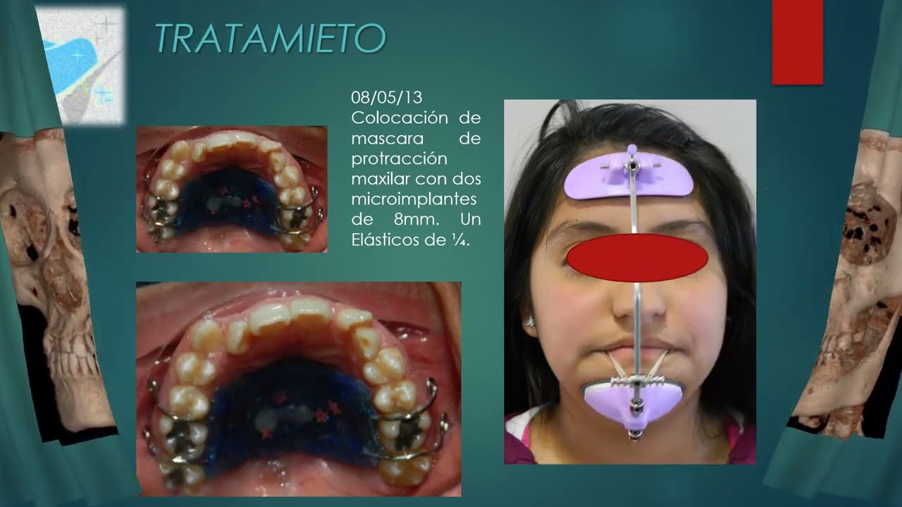 María Del Carmen Martínez Hinojosa-5