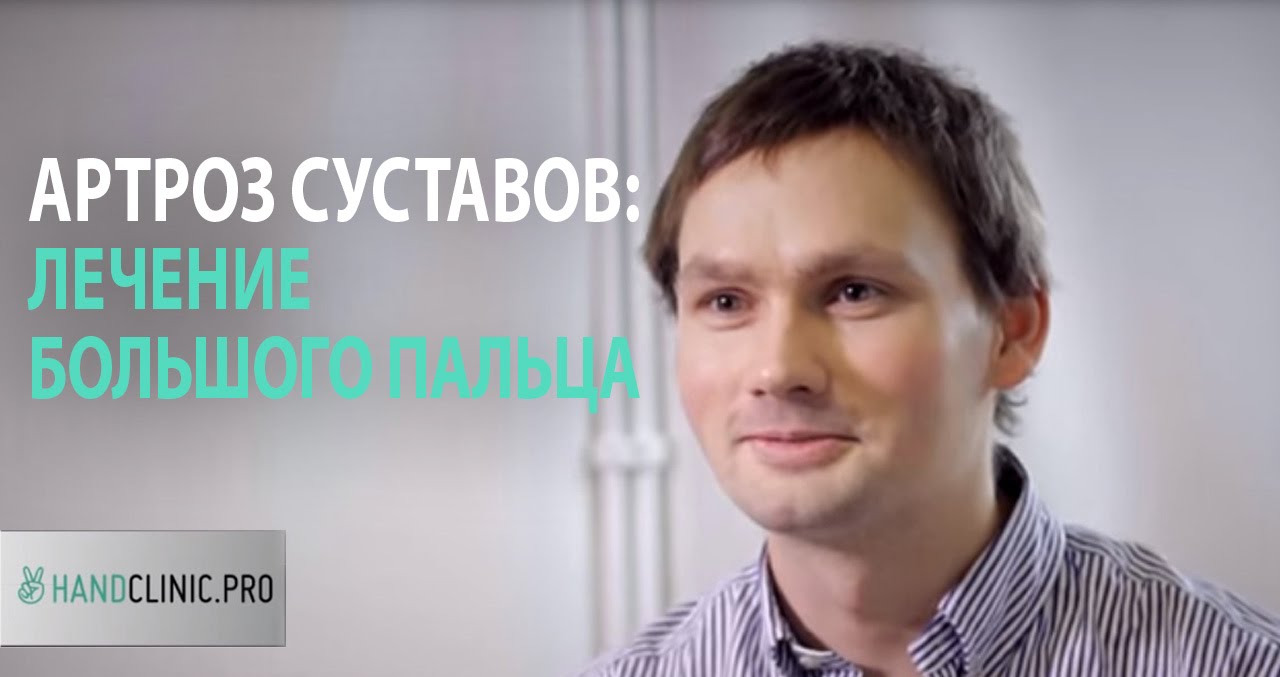 Артроз суставов: лечение артроза большого пальца руки