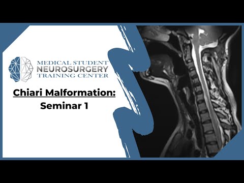 Chiari Malformation: Seminar 1