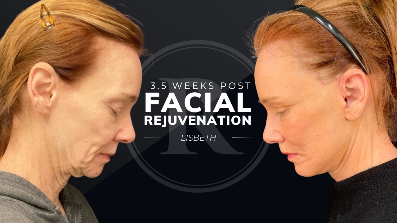 Robb Facial Plastic Surgery