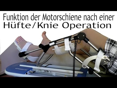 Hyaluron und Injektionen für gemeinsamen Preis Chirurgie Knieersatz Bewertungen Moskau