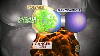 Teen creates cancer fighting technique