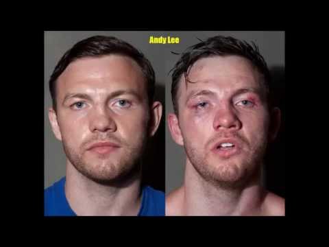 Boxers Faces 2017