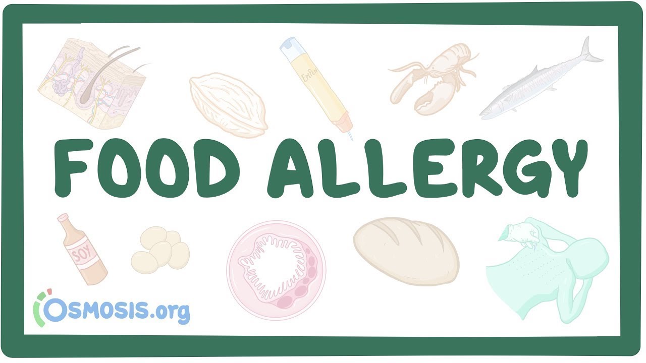 Food allergy - an Osmosis Preview
