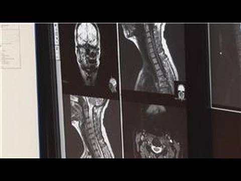 Radiology : What Is Radiology Used for?