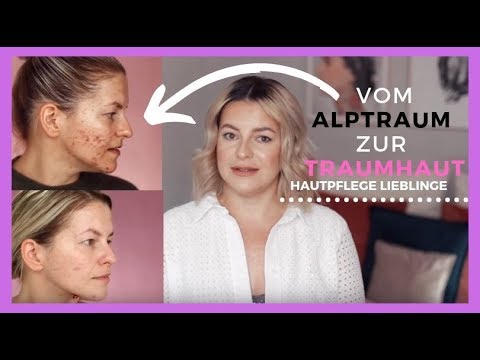 ❗️HAUTPFLEGE Lieblinge für Traumhaut 💦 Was ich neben MICRONEEDLING/DERMAROLLER nutze Vorher Nachher