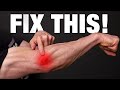 How to Fix Tennis Elbow (PERMANENTLY!)