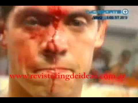 Ulises Lopez vs Sergio Sanders