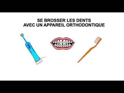 Vidéo explicative