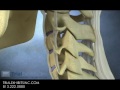 Anterior Subluxation in the Cervical Spine