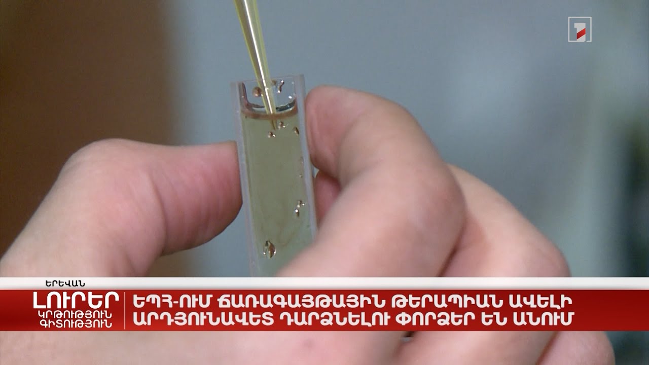 ԵՊՀ-ում ճառագայթային թերապիան ավելի արդյունավետ դարձնելու փորձեր են անում