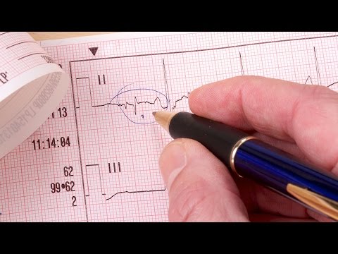 Human Physiology - Parasympathetic Innervation to the Heart
