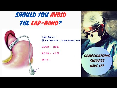 Overview of Laparoscopic Adjustable Gastric Banding