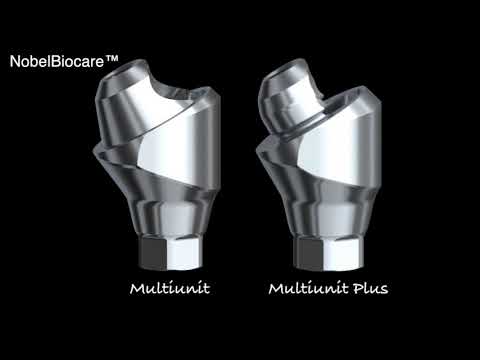 download lagu mp3 mp4 Nobel Replace Select 4 3, download lagu Nobel Replace Select 4 3 gratis, unduh video klip Nobel Replace Select 4 3