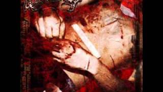 Avulsed - Edible Autopsy (cannibal corpse)