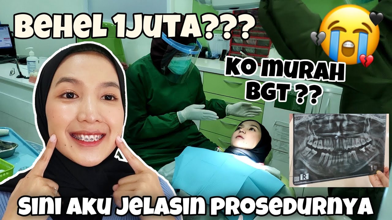 BEHEL STORY | Pengalaman Pasang Behel Gigi | Gimana sih rasanya Sakit banget #FDCDENTALCLINIC