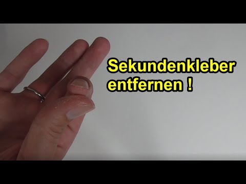 Die Schuppenflechte die Behandlung monoklonalnyje die Abwehrstoffe Vollständig hat die Schuppenflechte geheilt