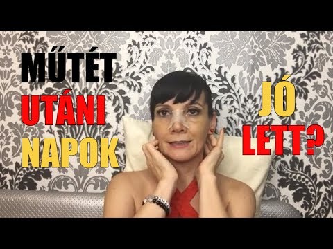 a visszér agyi keringésének kezelése