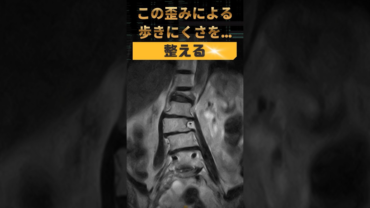 【整体】この歪みによる歩きにくさを…整える