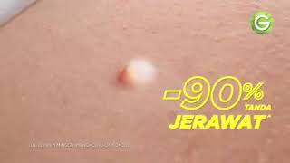 Download lagu Garnier bright complete anti acne serum TVC 2022-23 mp3